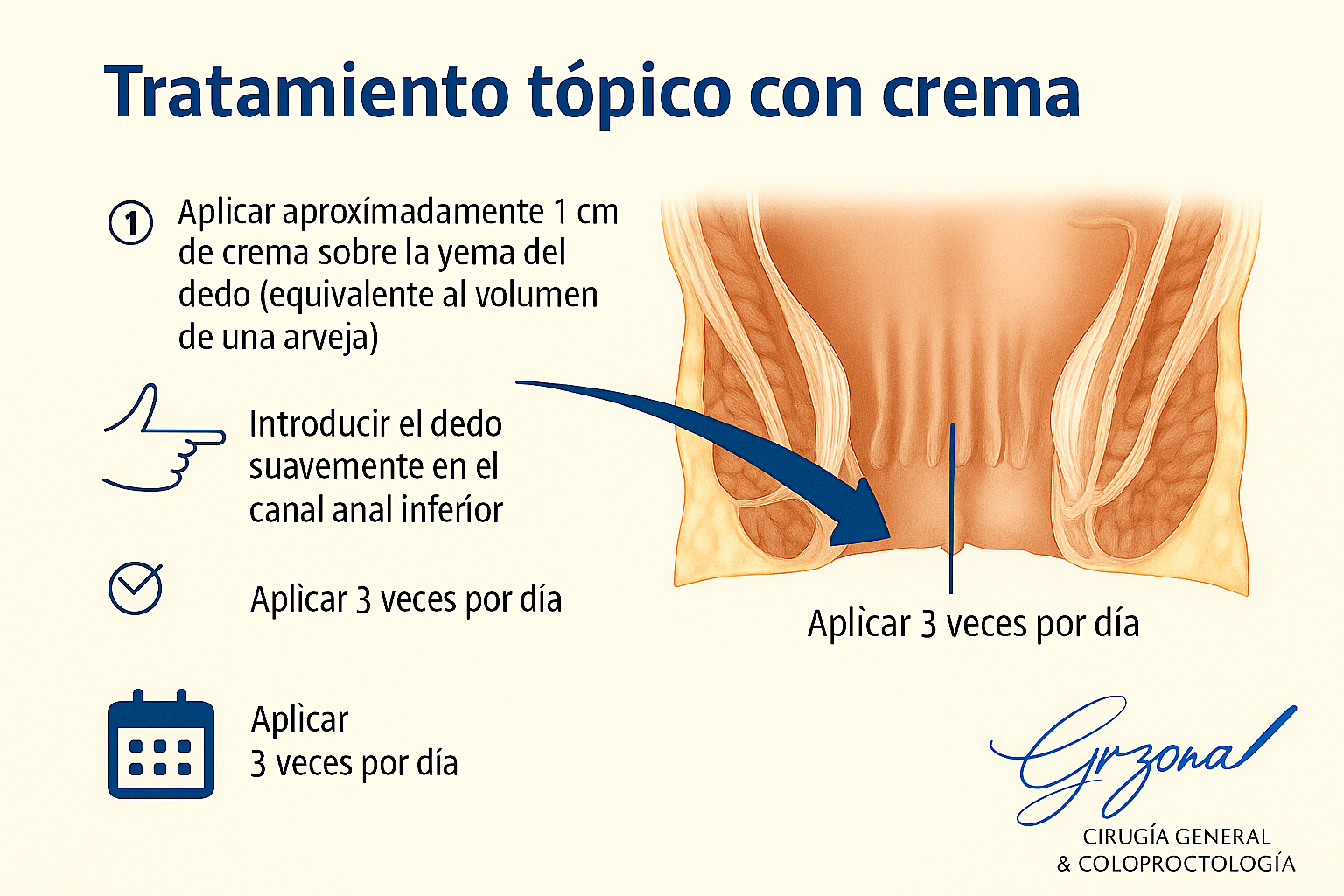 Indicaciones Colocacion de crema fisura